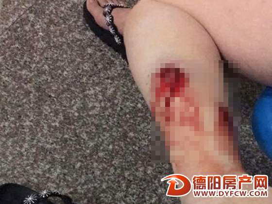 花雨树小区外有流浪狗出没咬伤多人